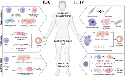 The forgotten key players in rheumatoid arthritis: IL-8 and IL-17 – Unmet needs and therapeutic perspectives